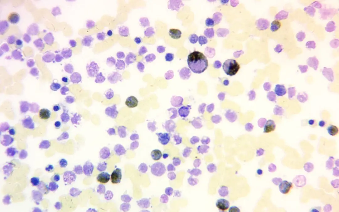 Myeloperoxidase Reaction (MPO) Stain