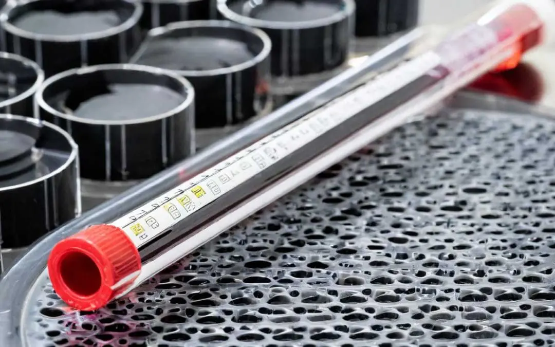 Erythrocyte Sedimentation Rate or ESR