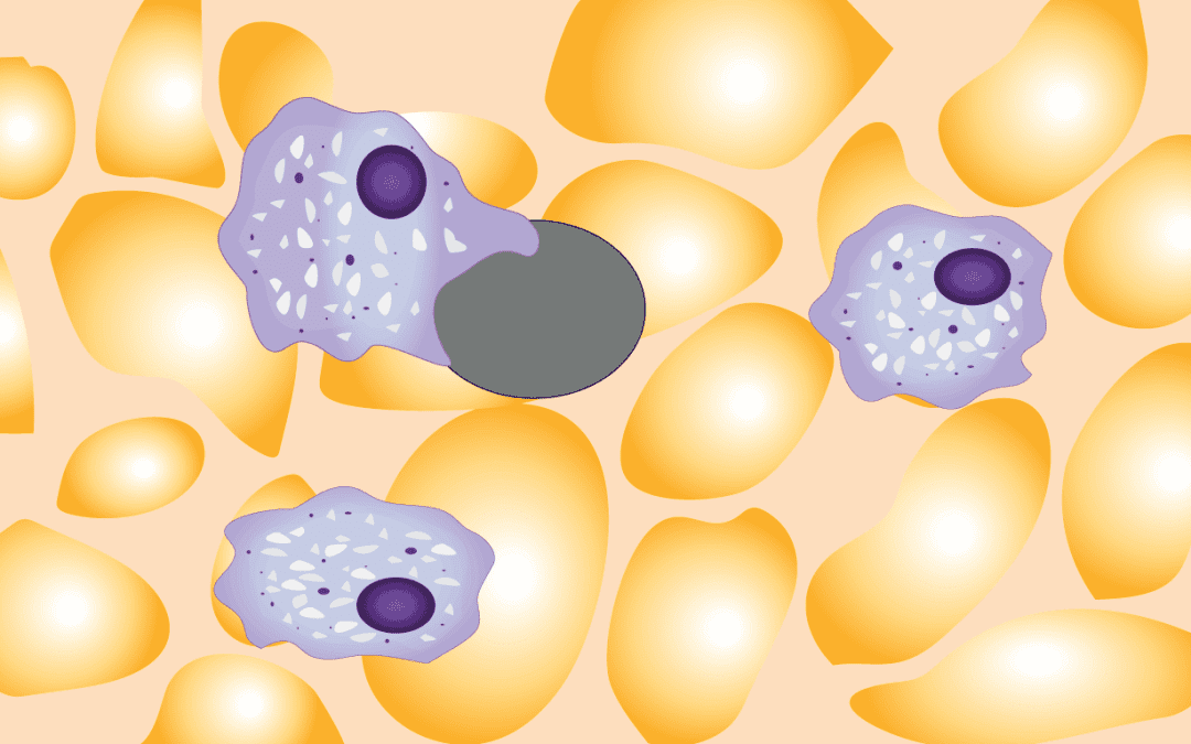 Primary Immune Thrombocytopenia or Primary ITP