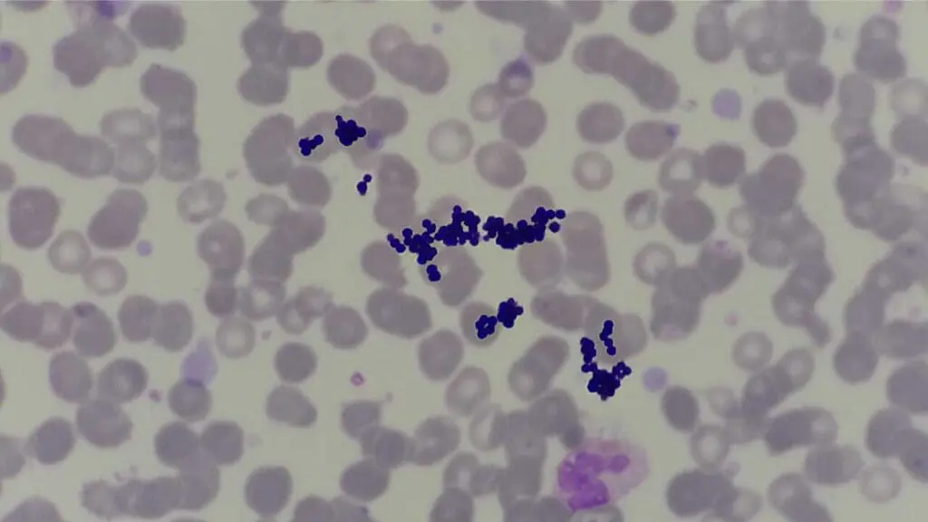 Stain deposits can sometimes appear similar to Gram-positive cocci bacteria if the stain is not filtered properly