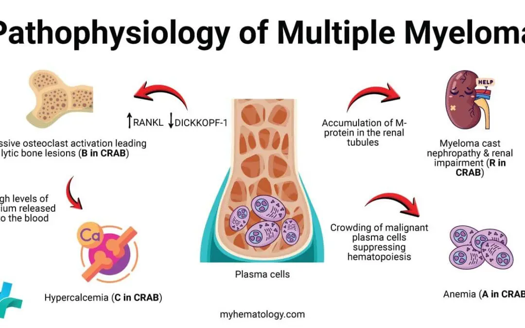 Multiple Myeloma