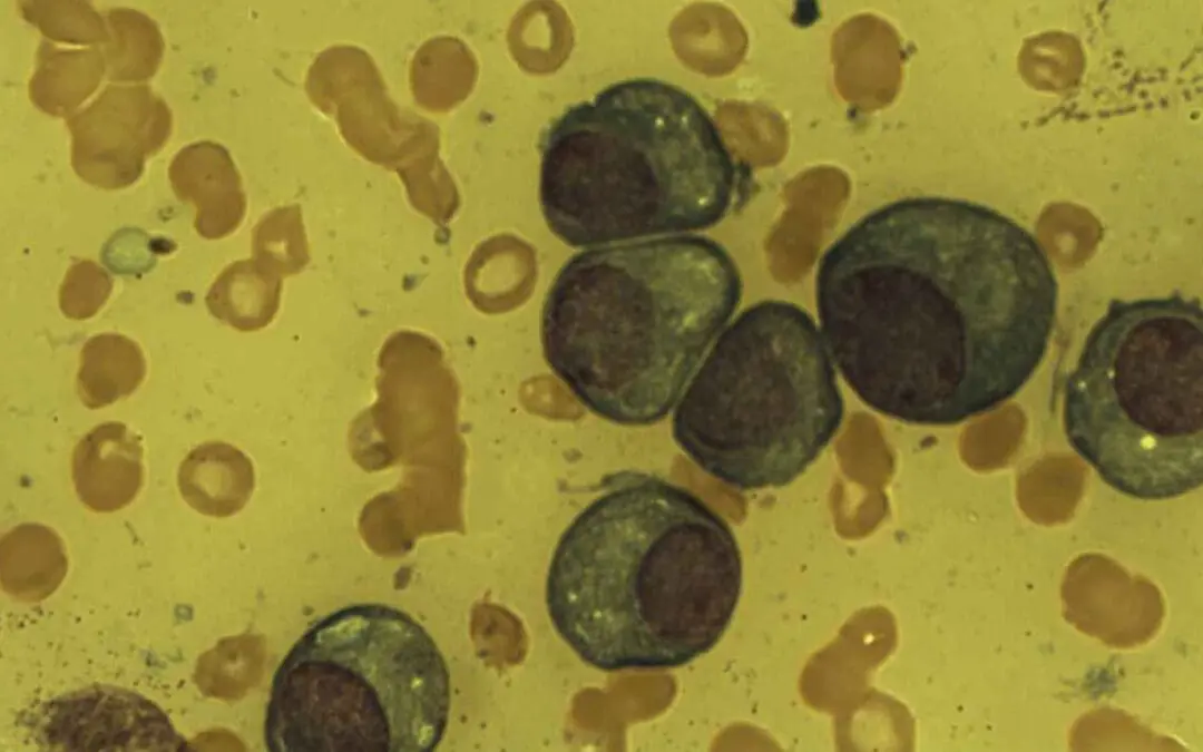 Plasma Cell