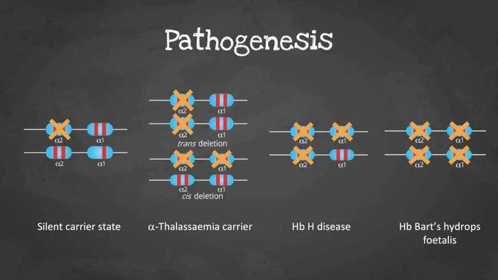 Alpha thalassemia severity scale based on the number of mutated alpha-globin genes