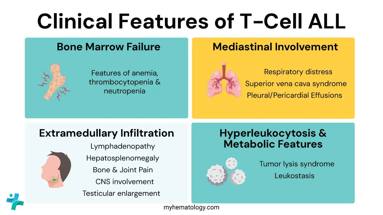 Clinical features of T-cell ALL include signs and symptoms of anemia, thrombocytopenia and neutropenia, mediastinal involvement, extramedullary infiltration, hyperleukocytosis and metabolic features.