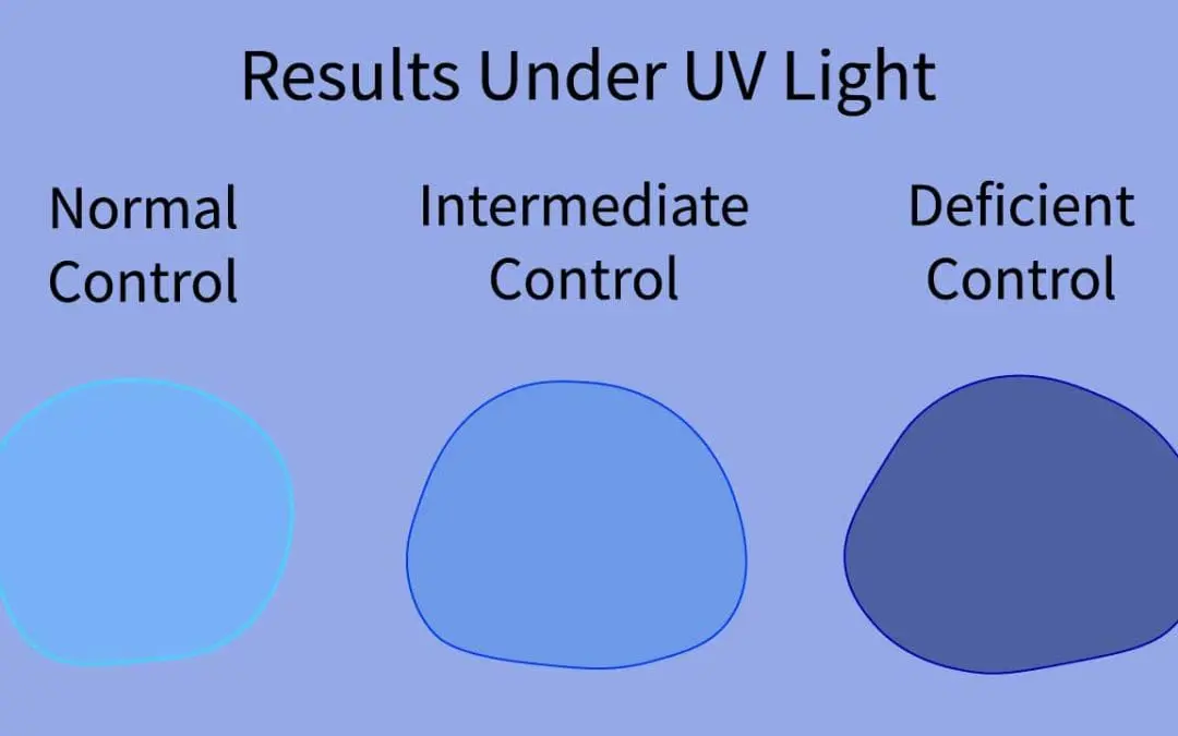Glucose-6-Phosphate Dehydrogenase (G6PD) Fluorescent Spot Test (G6PD Test)