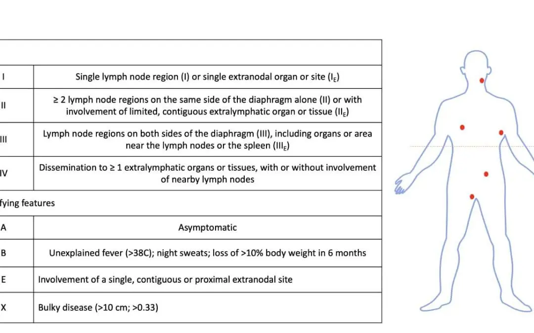 Classic Hodgkin Lymphoma Treatment Strategies