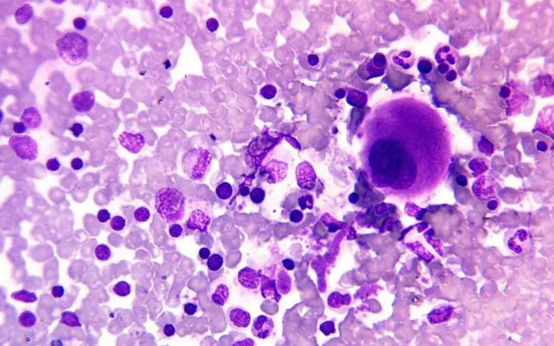 May-Grünwald Giemsa (MGG) Stain