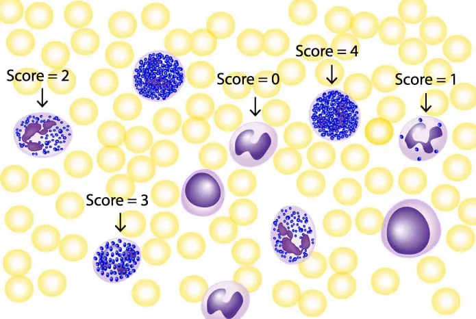 Leukocyte/Neutrophil Alkaline Phosphatase (LAP/NAP) Stain