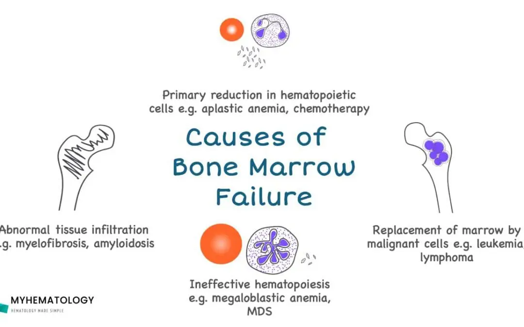 Bone Marrow Failure