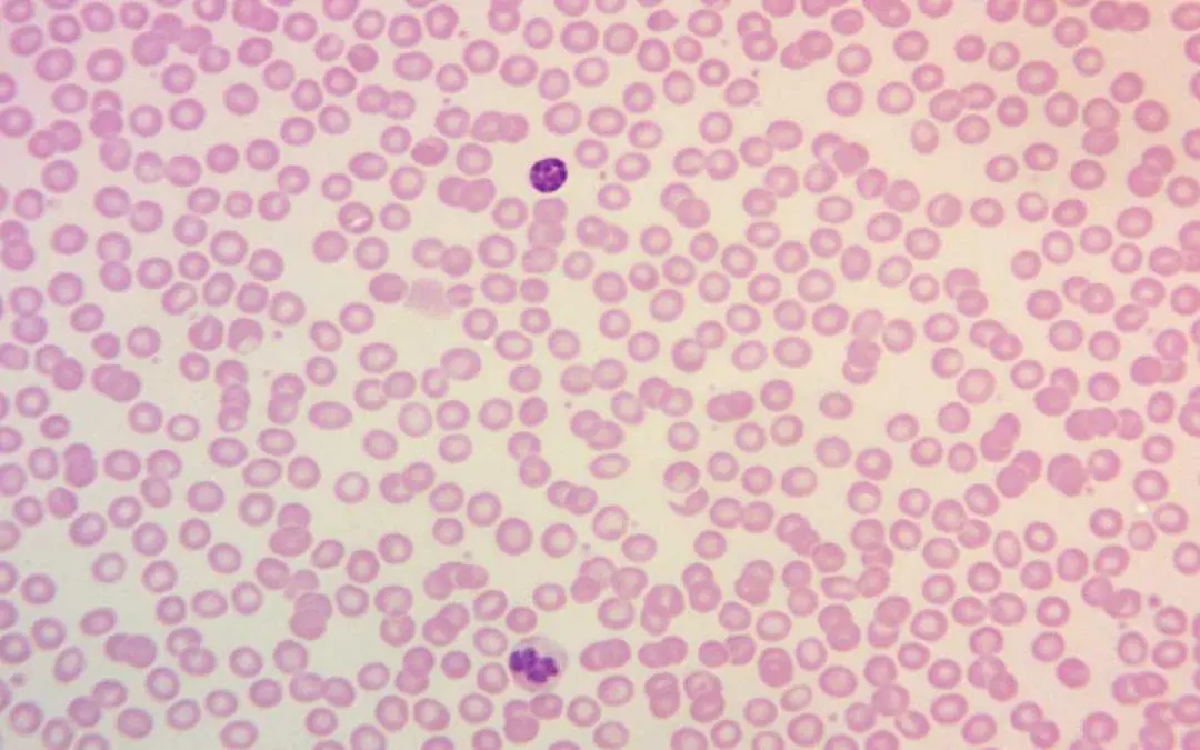 Leishman Stain for Peripheral Blood Smear