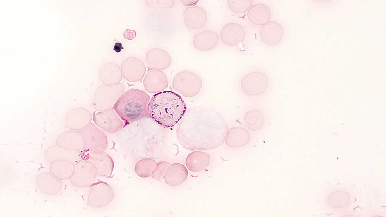 Periodic Acid Schiff Stain (PAS Staining)