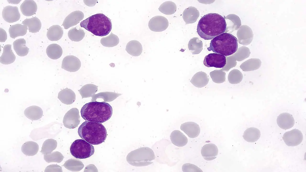 Hemato-Oncology: Recognizing Blood and Cancer