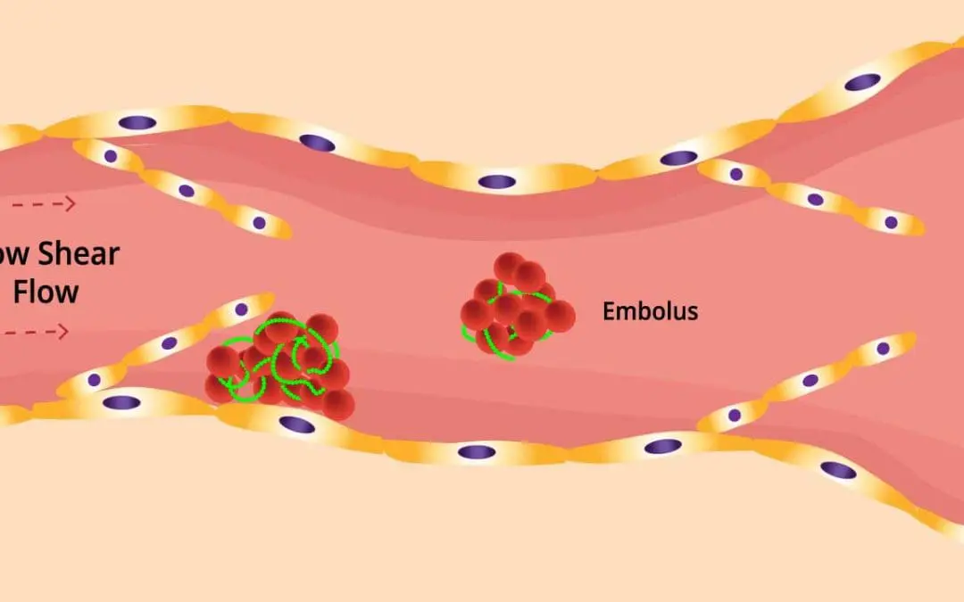 Venous Thrombosis (VTE)