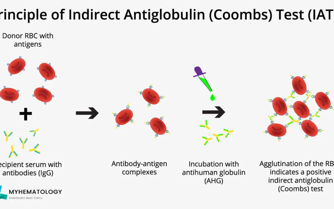 Indirect Antiglobulin (Coombs) Test (IAT)