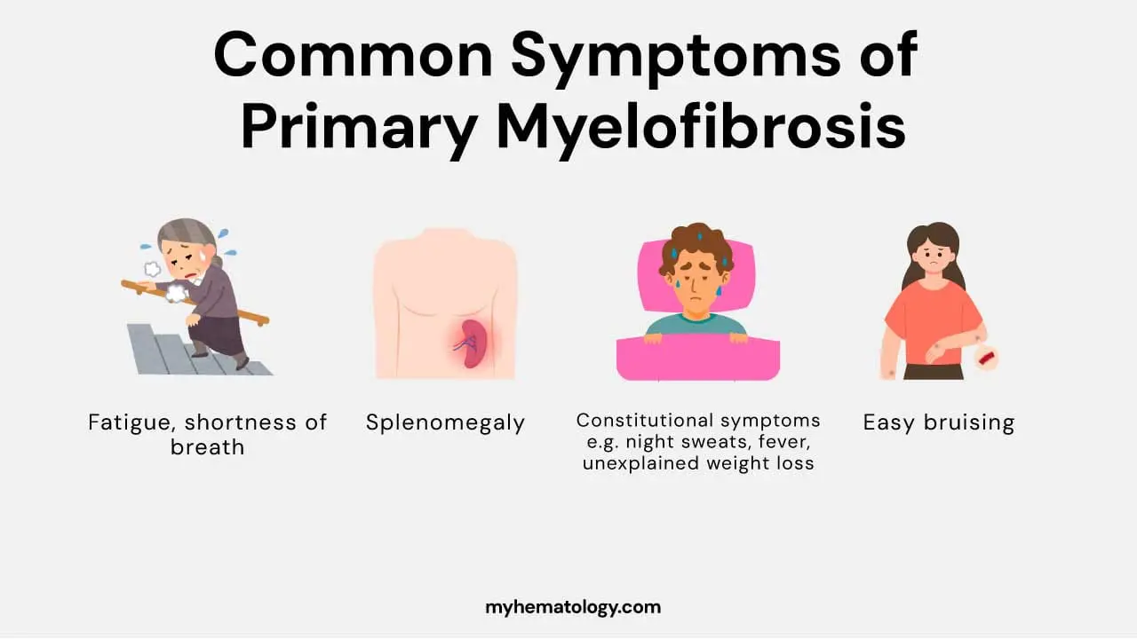 A schematic diagram displaying three key signs and symptoms of primary myelofibrosis (PMF): anemia, massive hepatosplenomegaly, and hypermetabolism. 
