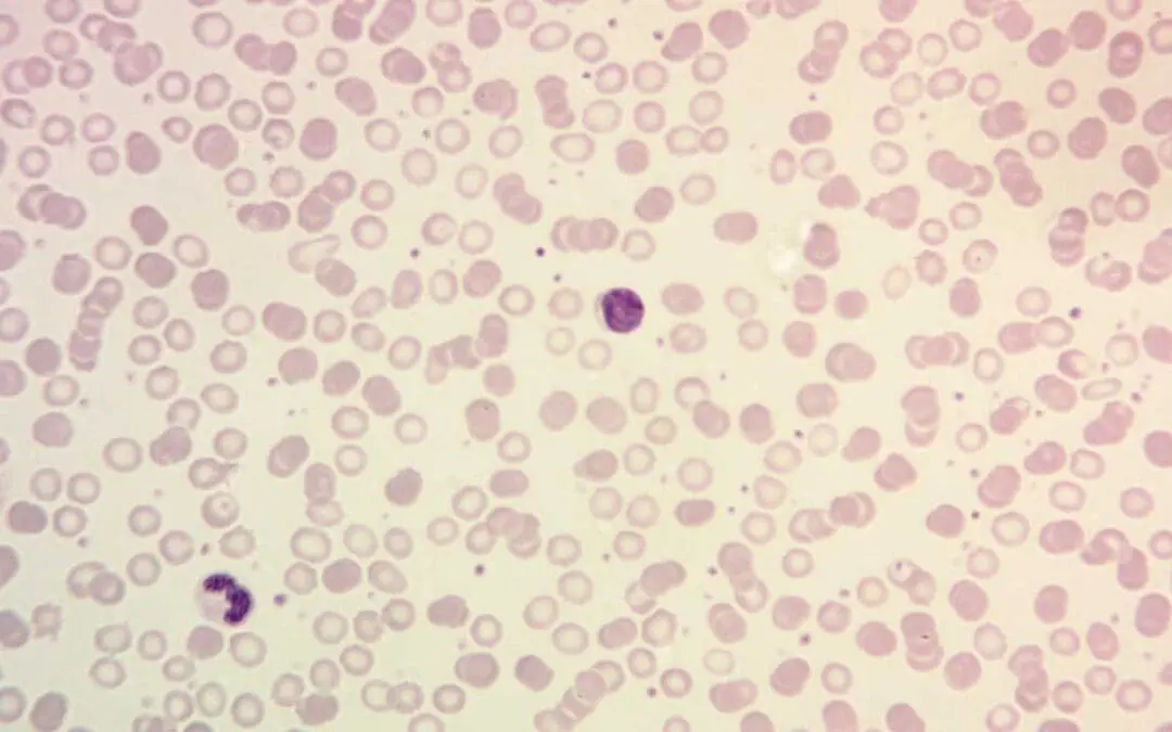 Hematopathology