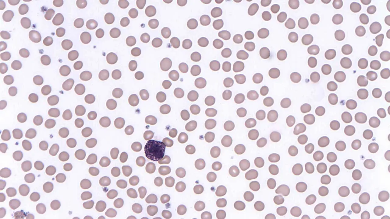 Basophils