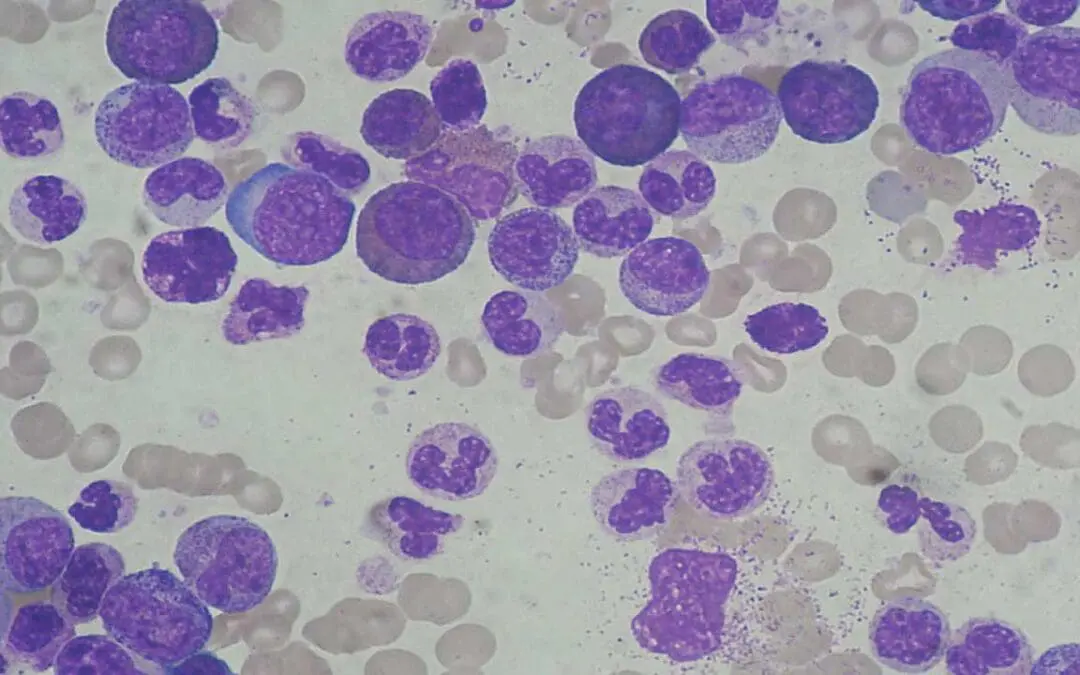 Leukocytosis
