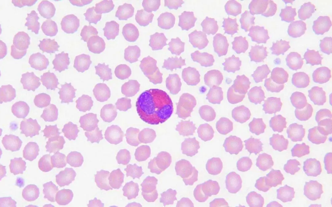 Eosinophils