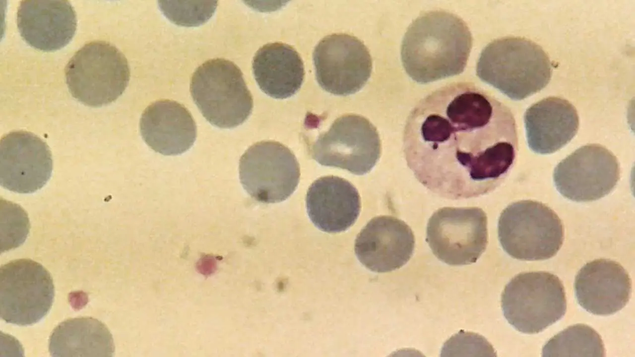 Neutrophils