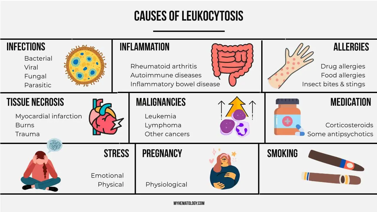 There are several causes of leukocytosis. Leukocytosis is usually an indicator of an underlying problem or disease. 