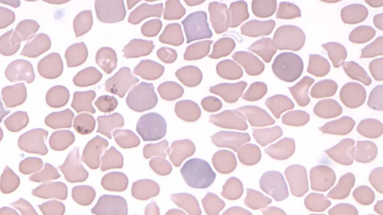 Polychromatic red cells or polychromasia are immature red cells known as reticulocytes. They are larger and stain with a bluish hue compared to mature red cells.