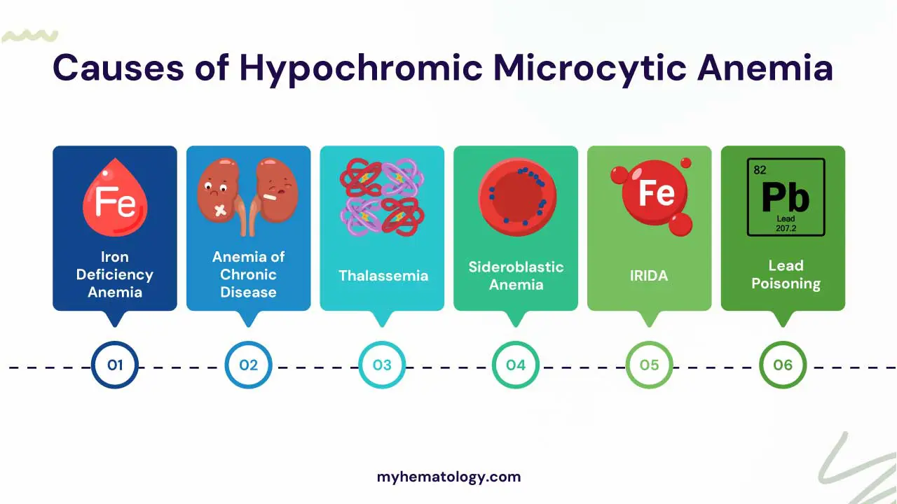 Causes of hypochromic microcytic anemia include iron deficiency anemia, anemia of chronic disease, thalassemia, sideroblastic anemia, IRIDA and lead poisoning. 