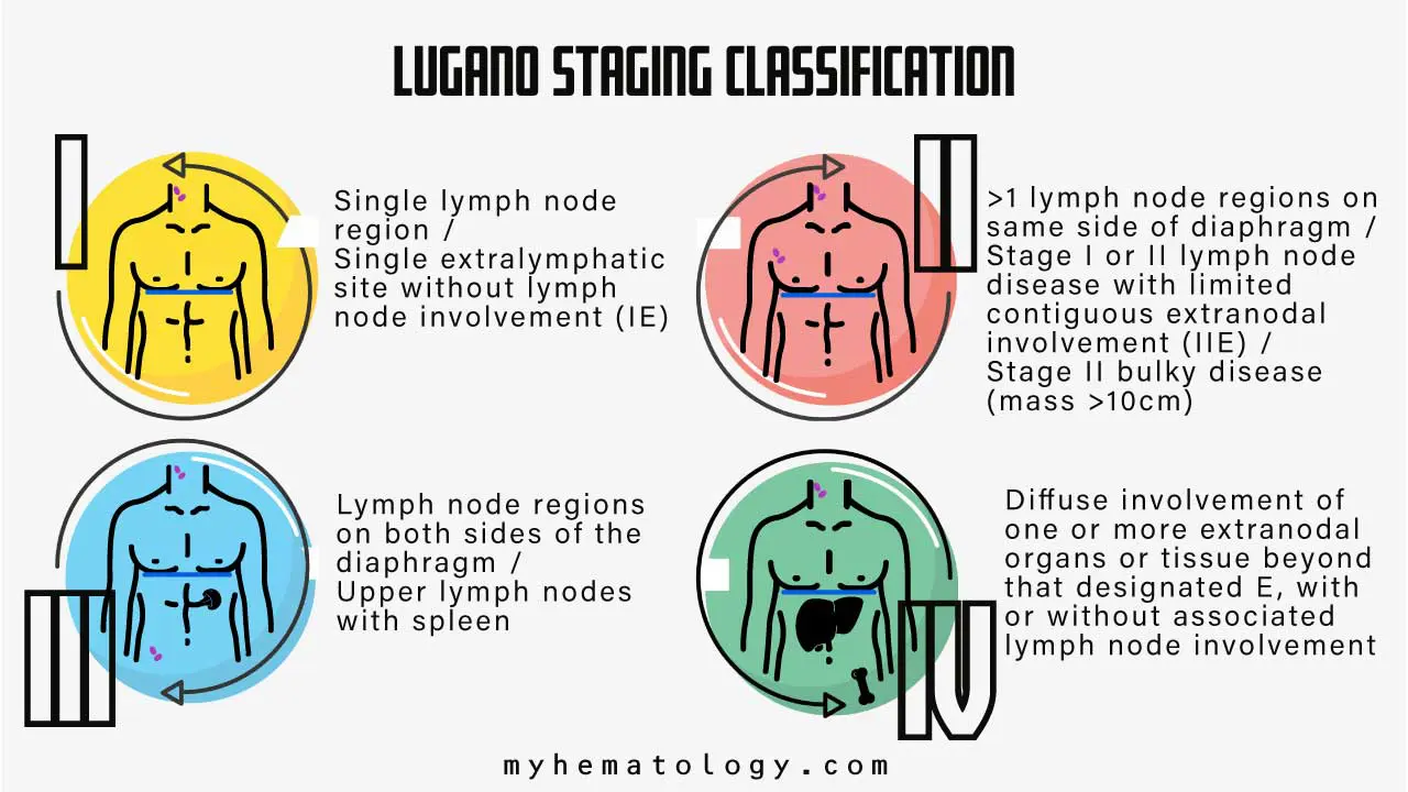 Infograph on the Lugano Staging