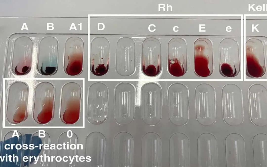 Rh Blood Group System