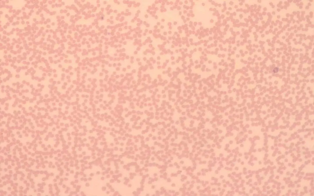Neutropenia