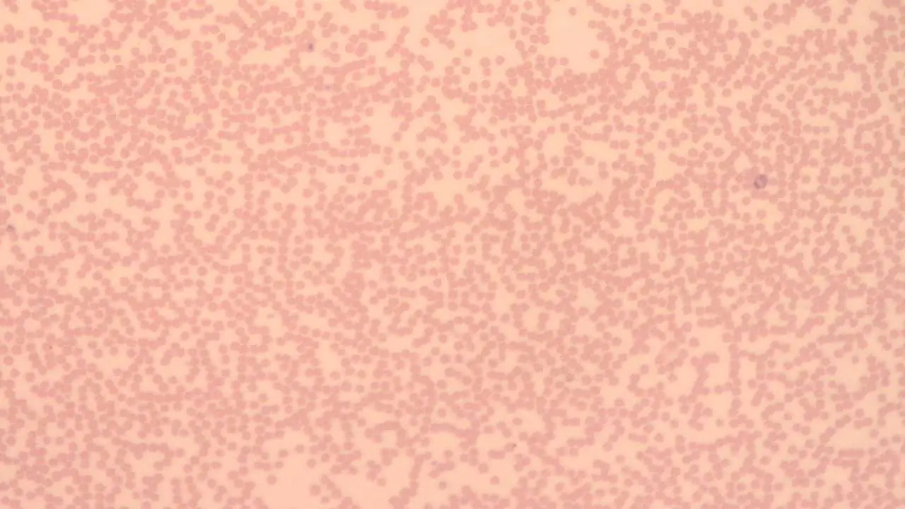 Neutropenia
