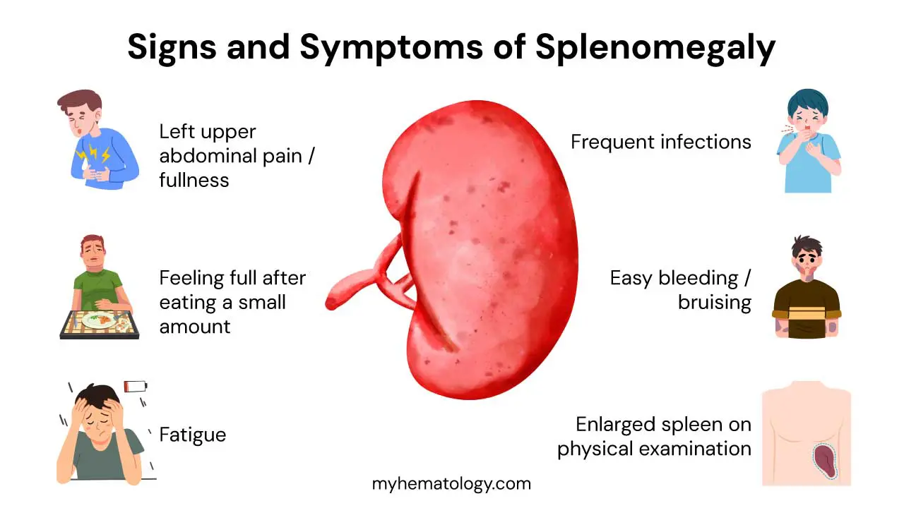 Signs and symptoms of splenomegaly