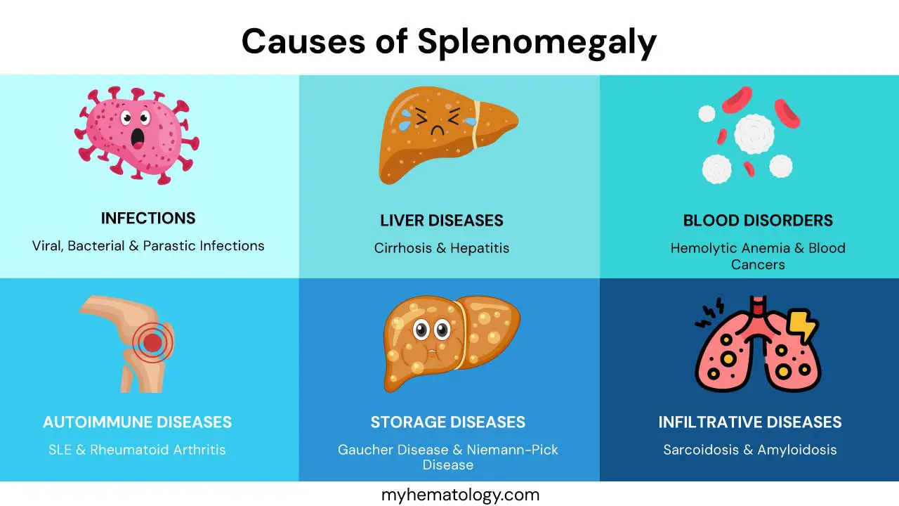 Causes of splenomegaly include infections, liver disorders, blood disorders, autoimmune diseases, storage diseases and infiltrative diseases