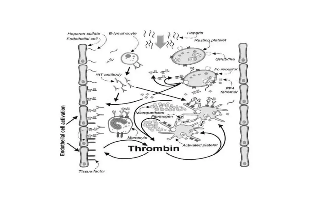 Heparin-Induced Thrombocytopenia