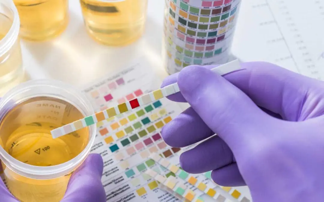 Hemoglobinuria: Overview and Causes