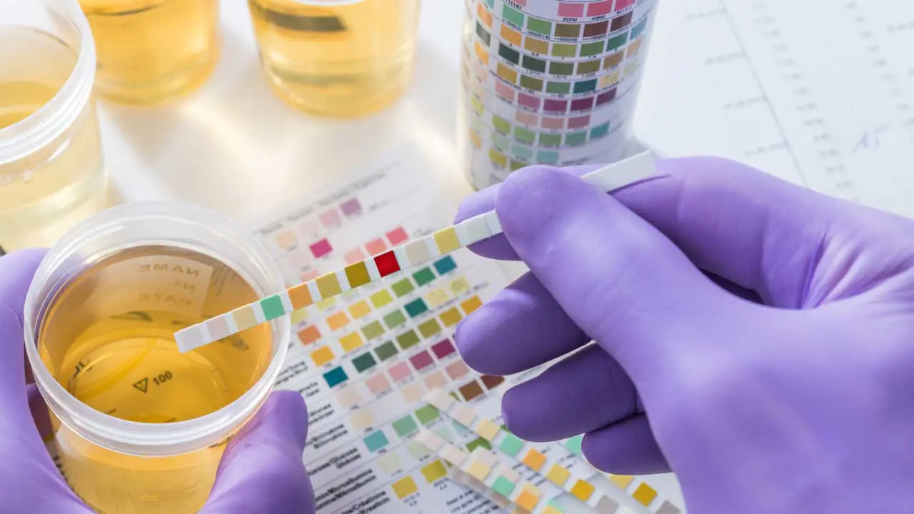 Hemoglobinuria: Overview and Causes