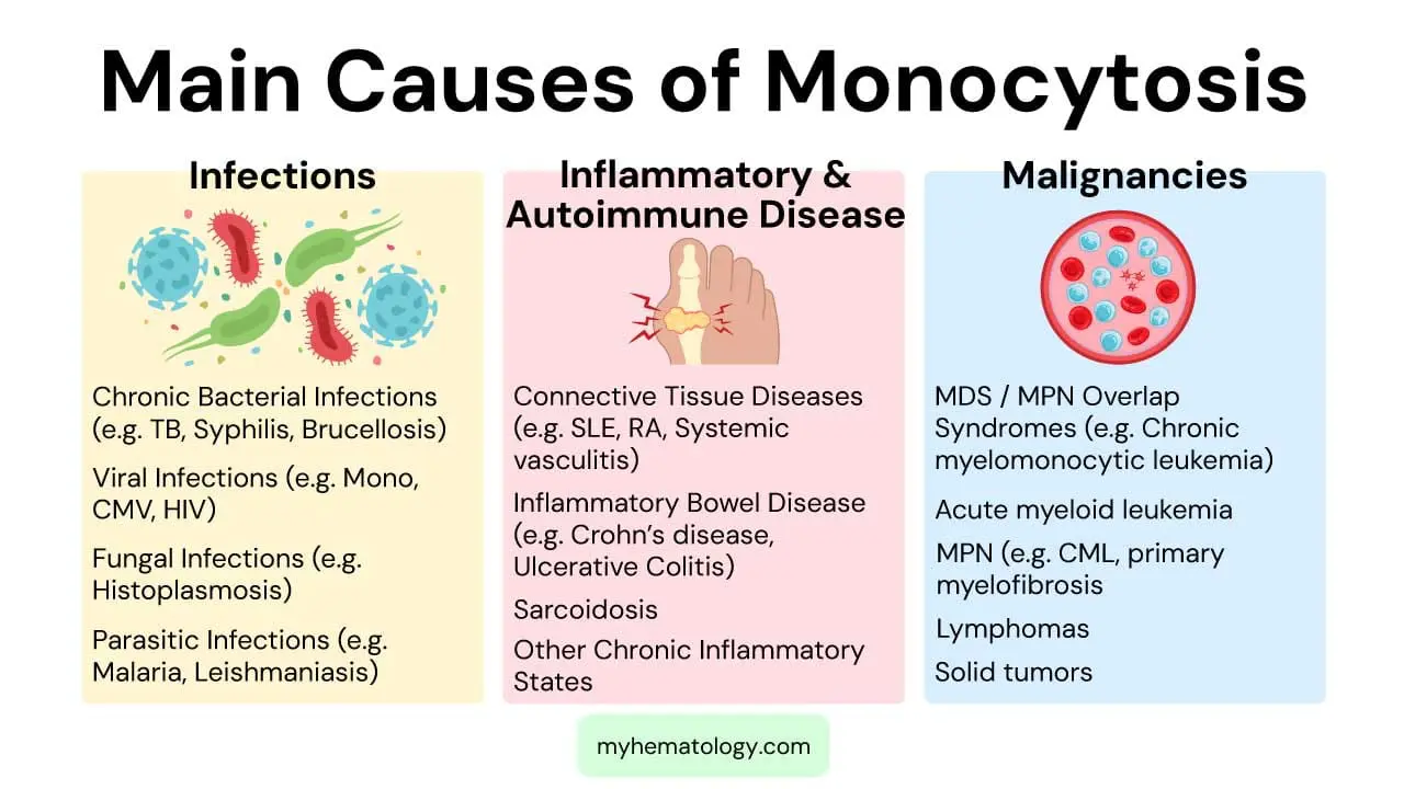 Main causes of monocytosis also known as high monocytes includes infections, inflammatory & autoimmune diseases and malignancies