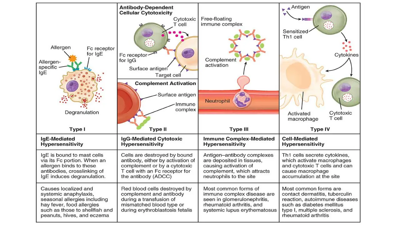 Hypersensitivity reactions are categorized into four distinct types based on their underlying immune mechanisms. Type I hypersensitivity is mediated by IgE antibodies, leading to the activation of mast cells and basophils, which then release potent vasoactive mediators. In contrast, Type II hypersensitivity involves IgG (and sometimes IgM) antibodies that trigger either complement activation or antibody-dependent cellular cytotoxicity (ADCC), resulting in cell damage. Type III hypersensitivity occurs due to the formation of immune complexes, which subsequently induce the classical complement pathway, leading to a significant inflammatory response and a massive infiltration of neutrophils. Finally, Type IV hypersensitivity is primarily mediated by Th1 cells that release cytokines, responsible for activating macrophages and orchestrating a cell-mediated inflammatory response.