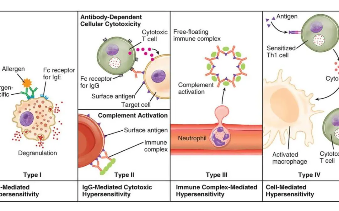 Hypersensitivity Reactions: Causes and Mechanisms
