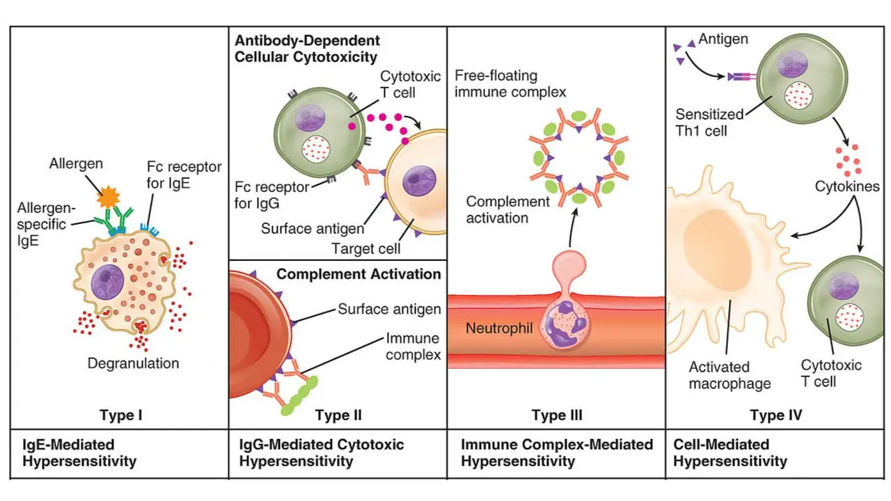 Hypersensitivity Reactions: Causes and Mechanisms
