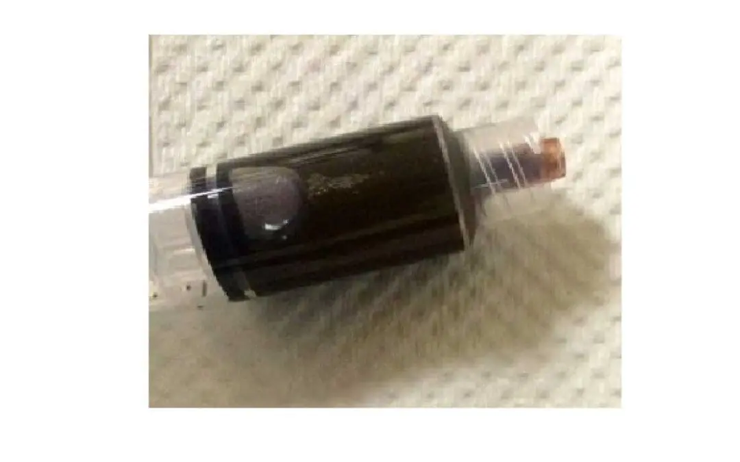 Methemoglobinemia
