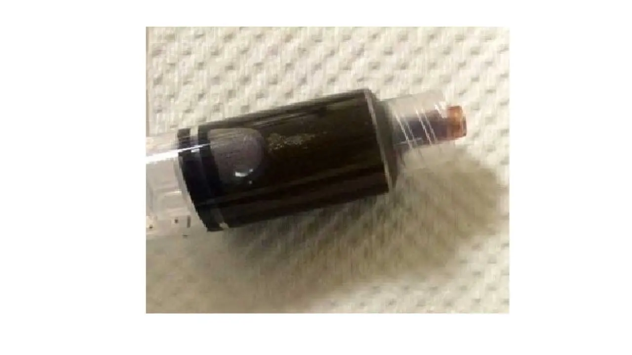 Methemoglobinemia