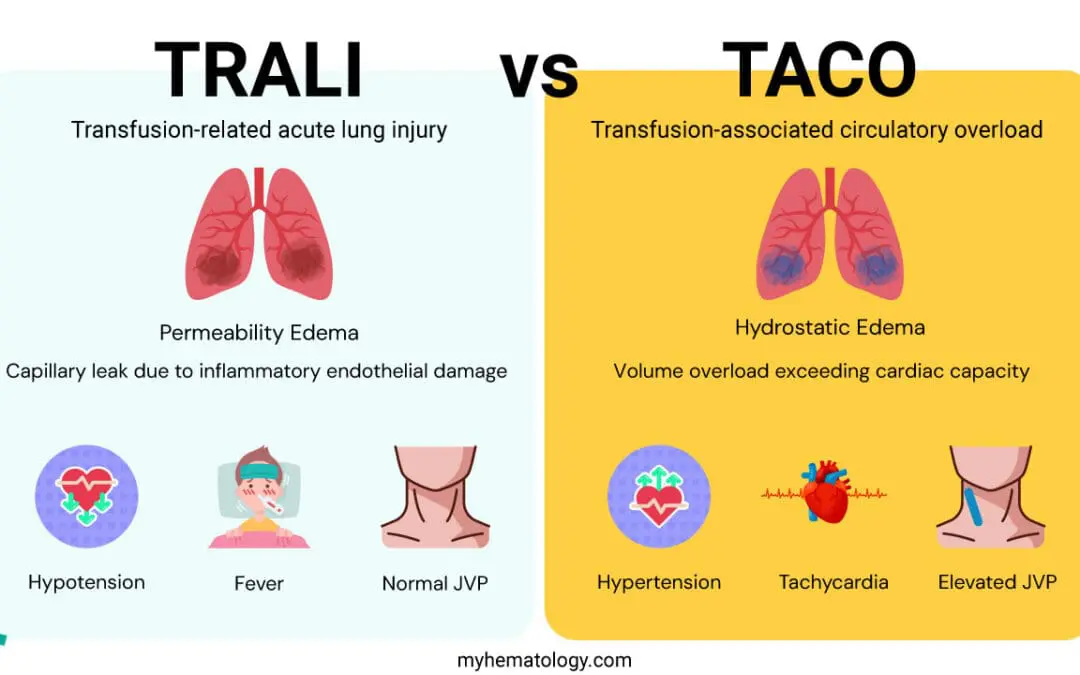 Transfusion-Associated Circulatory Overload or TACO