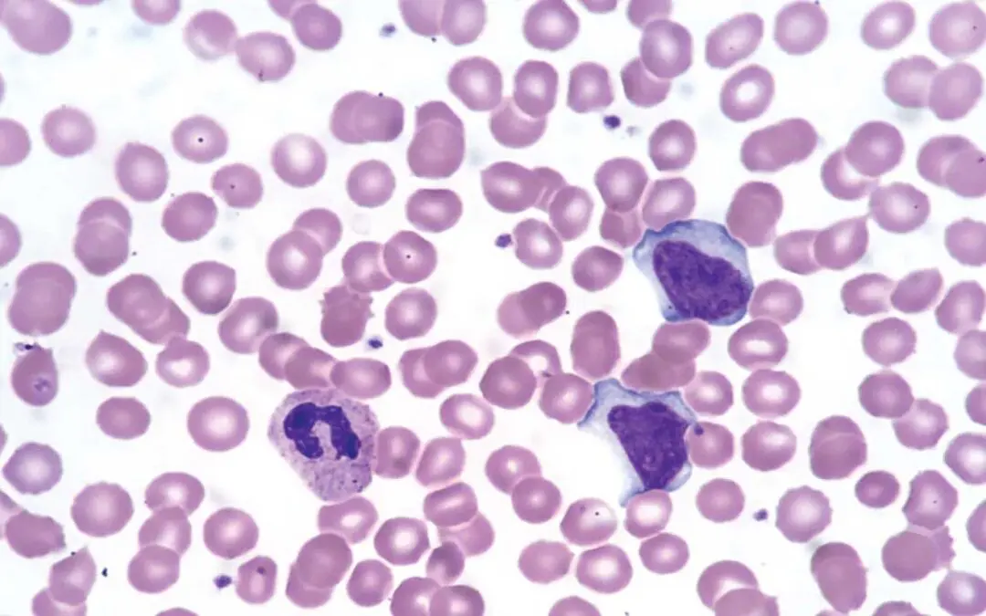 Wright Stain for Peripheral Blood Smear