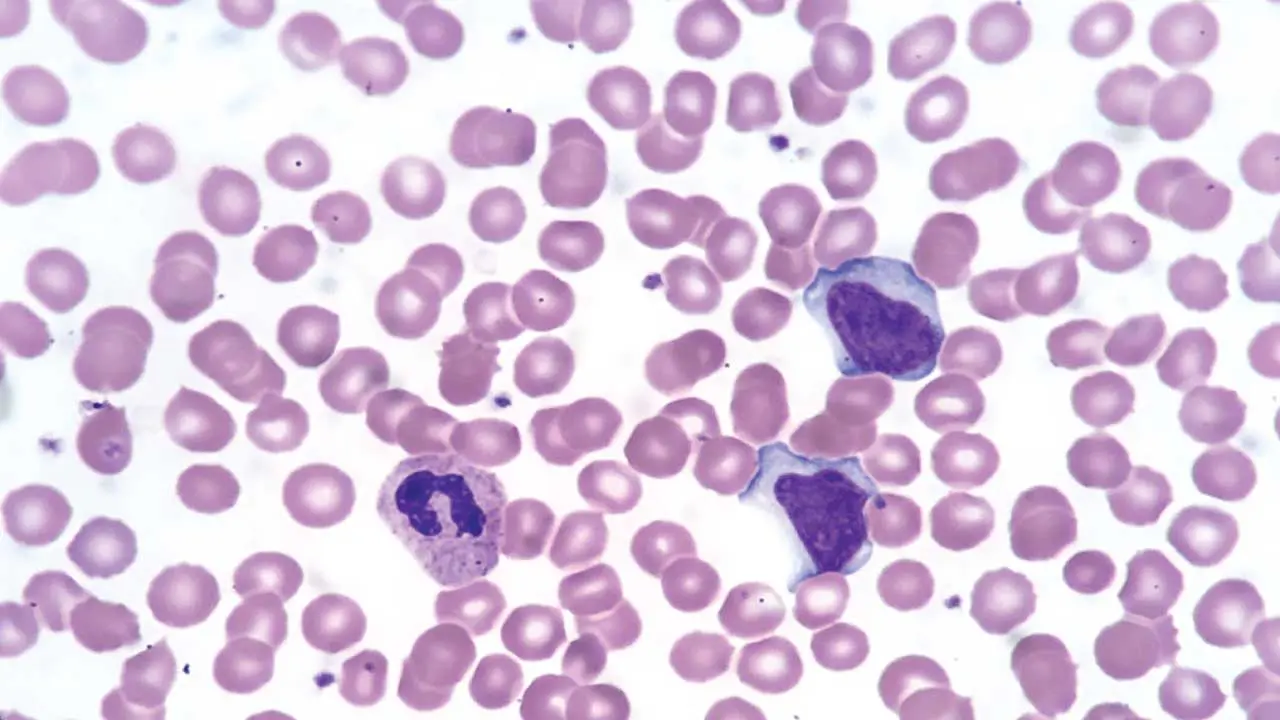 Wright Stain for Peripheral Blood Smear