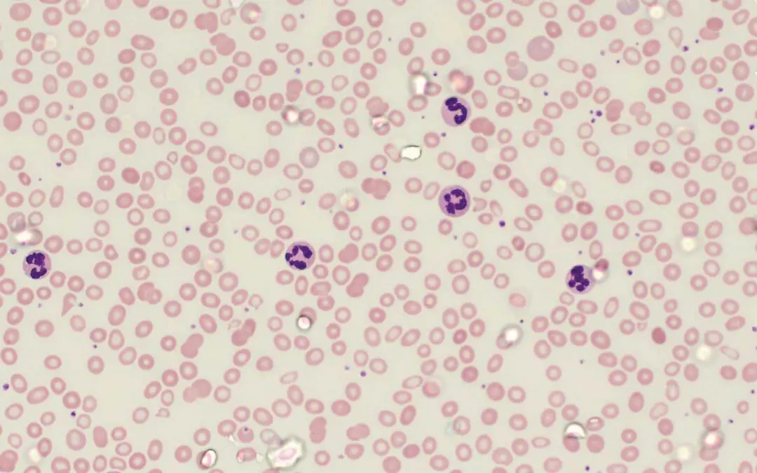 Wright-Giemsa Stain
