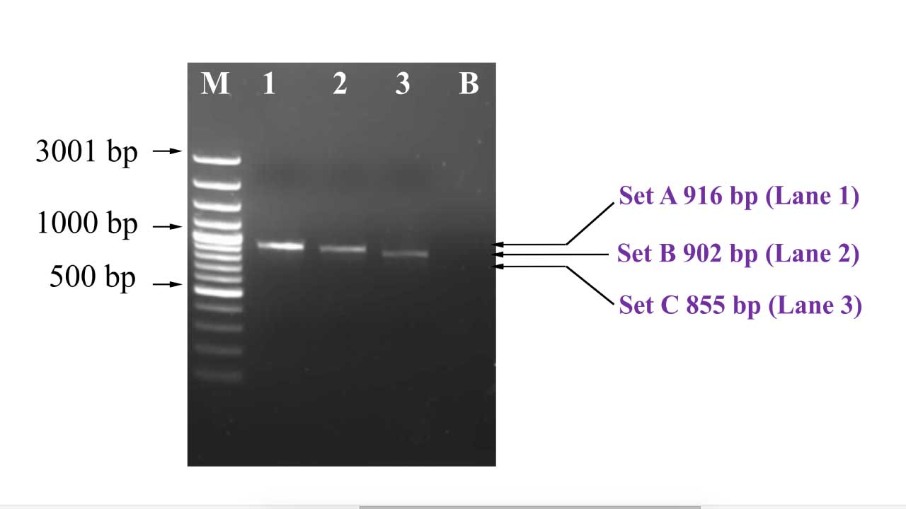 Agarose Gel Electrophoresis Preparation: Principle & Protocol