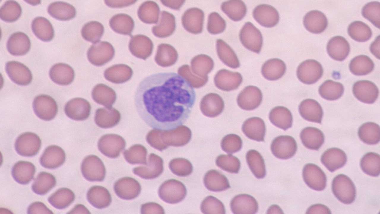Monocytes Definition, Function, Causes of High and Low Count