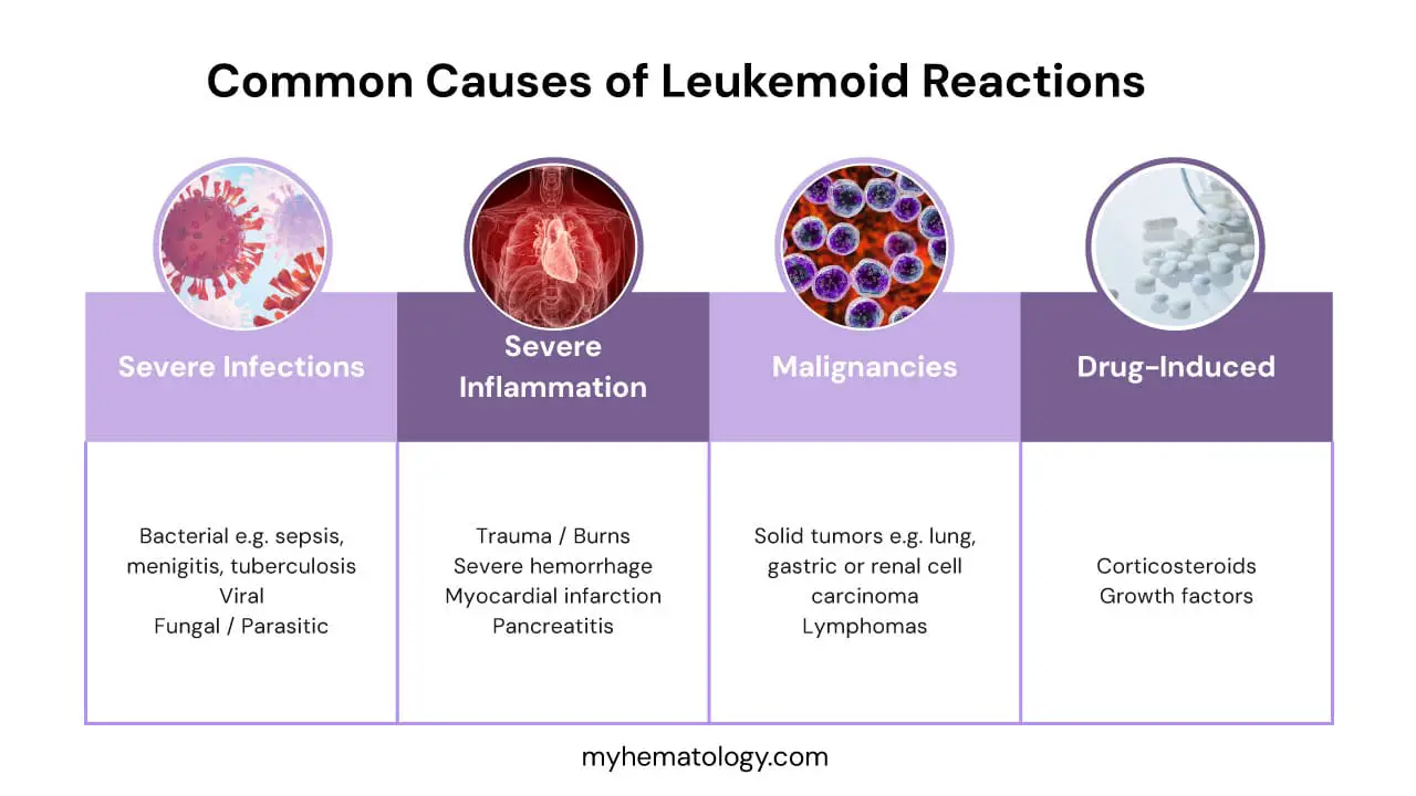 Common causes of a leukemoid reaction include severe infections, severe inflmmation, malignancies and certain medications. 