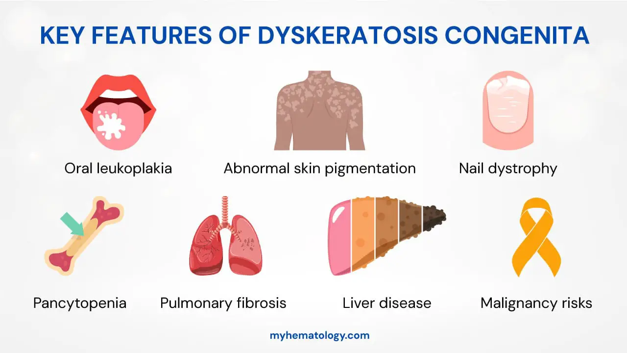 Key features of dyskeratosis congenita